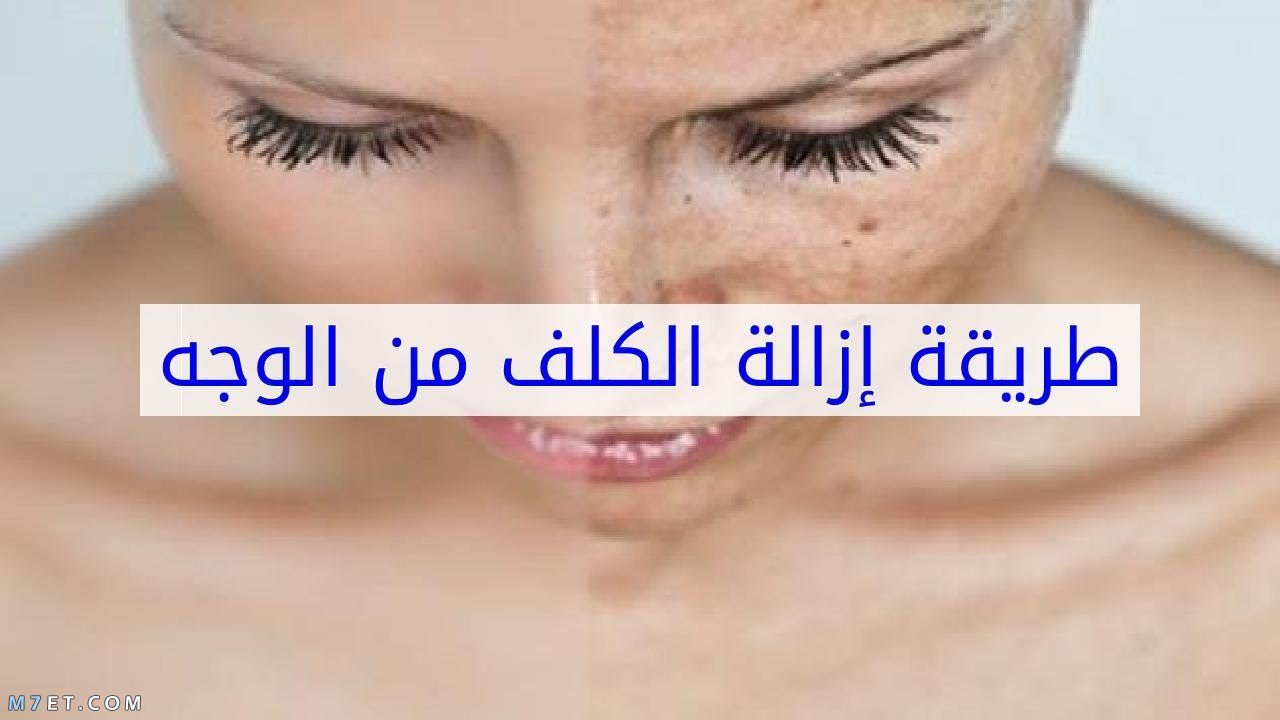 كيفية علاج الكلف والتصبغات وأسبابه .. خلطات علاج الكلف وتصبغات الوجه مجربة