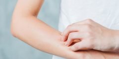 أسباب حساسية الجلد المفاجئة