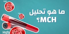 تعرف ماهو تحليل mcv