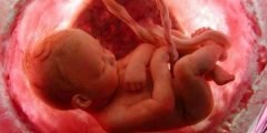 اسباب موت الجنين في الشهر الثاني