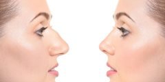 تجميل الأنف بدون عمليات جراحية 