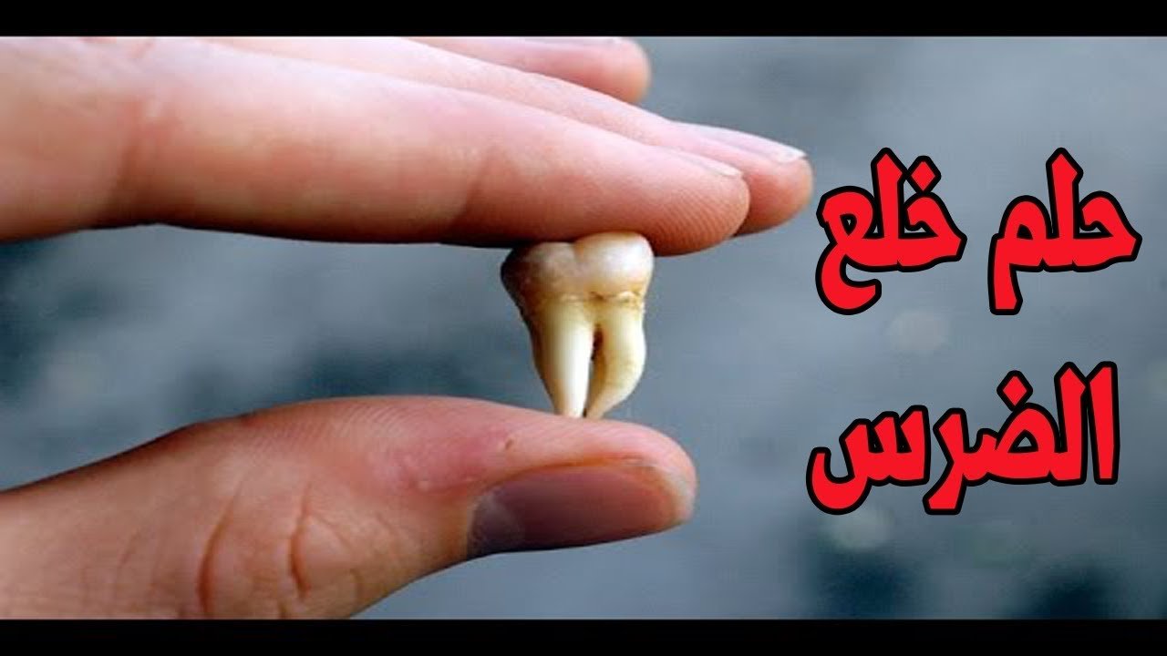 تفسير خلع الضرس المسوس في المنام للعزباء