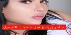 صور سامر بريطع قبل عمليات التجميل
