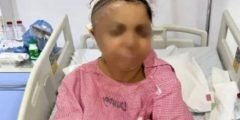 قصة الاعتداء على عاملة منزلية من قبل 3 سيدات وشاب في حائل