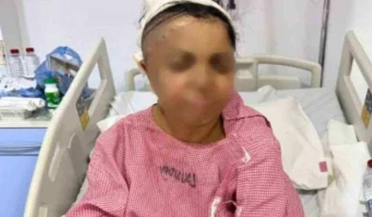 قصة الاعتداء على عاملة منزلية من قبل 3 سيدات وشاب في حائل